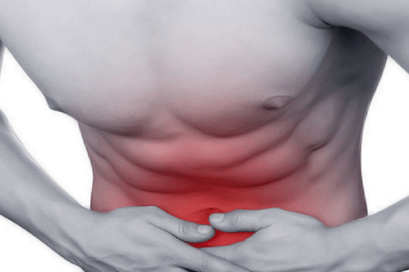 Abdominal pain in chronic prostatitis